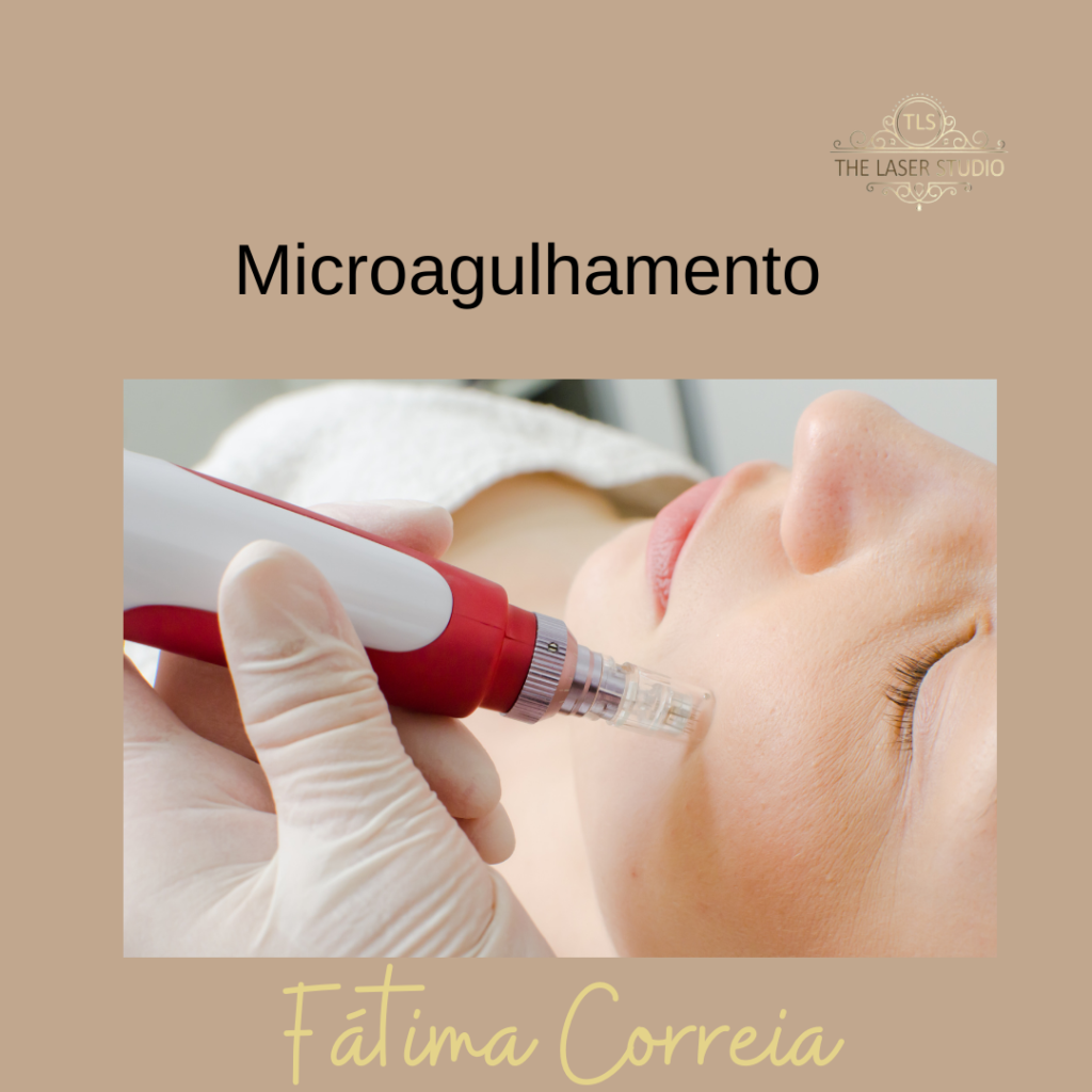 Microagulhamento